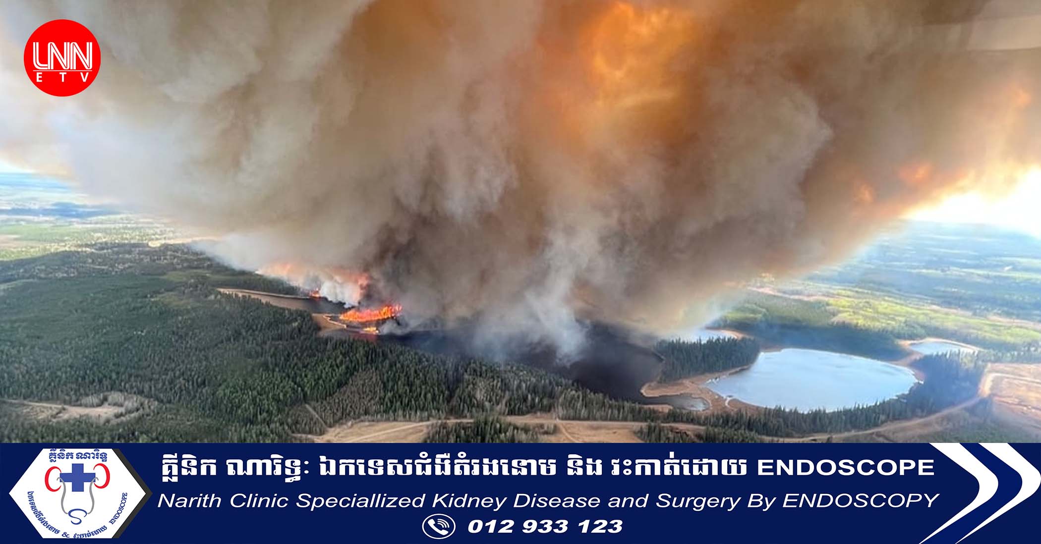 ភ្លើងឆេះព្រៃនៅកាណាដា បង្ខំឱ្យមនុស្សជាង ១៥ម៉ឺននាក់ភៀសខ្លួនចេញពីផ្ទះសម្បែង