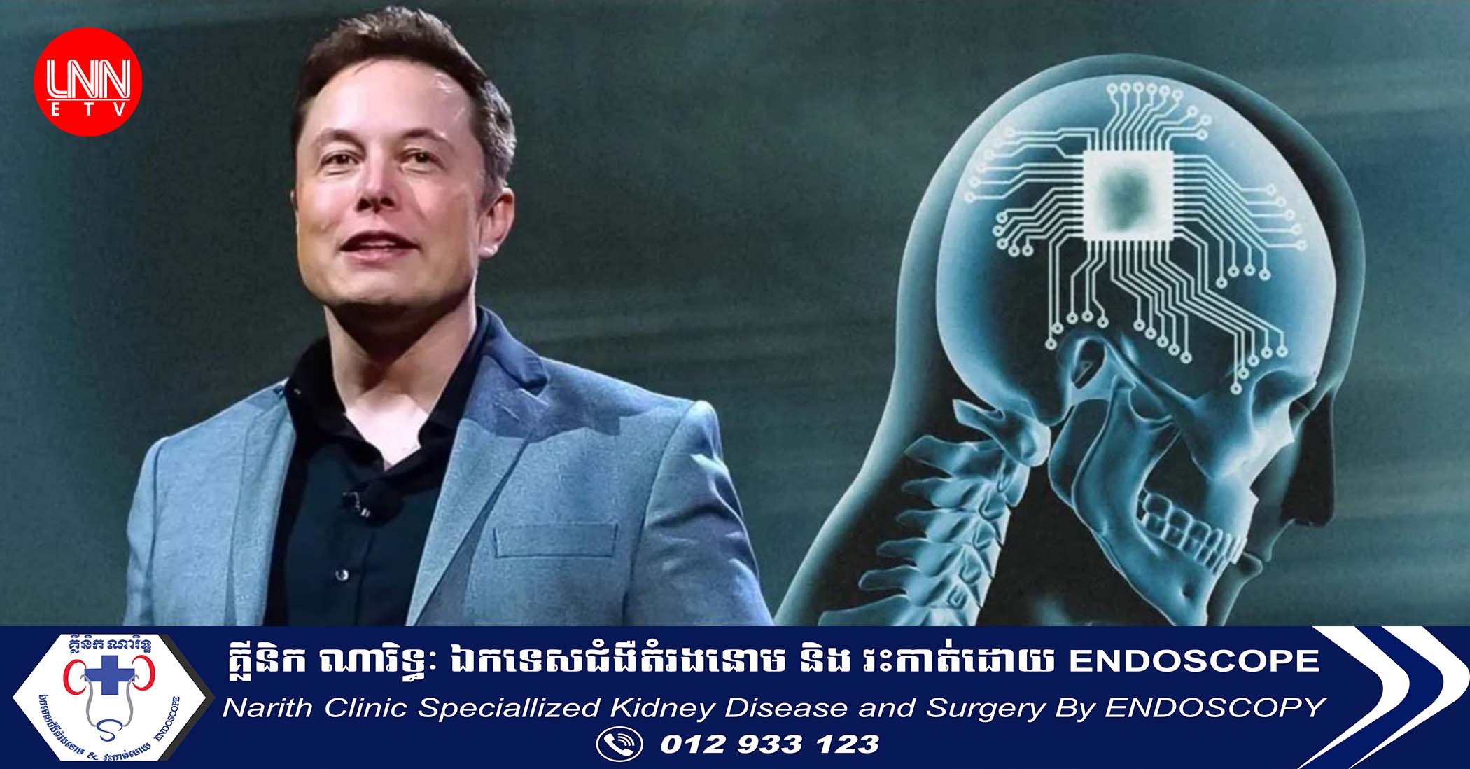មហាសេដ្ឋី Elon Musk គ្រោងបង្កើត​ក្រុមហ៊ុន AI សាជាថ្មី