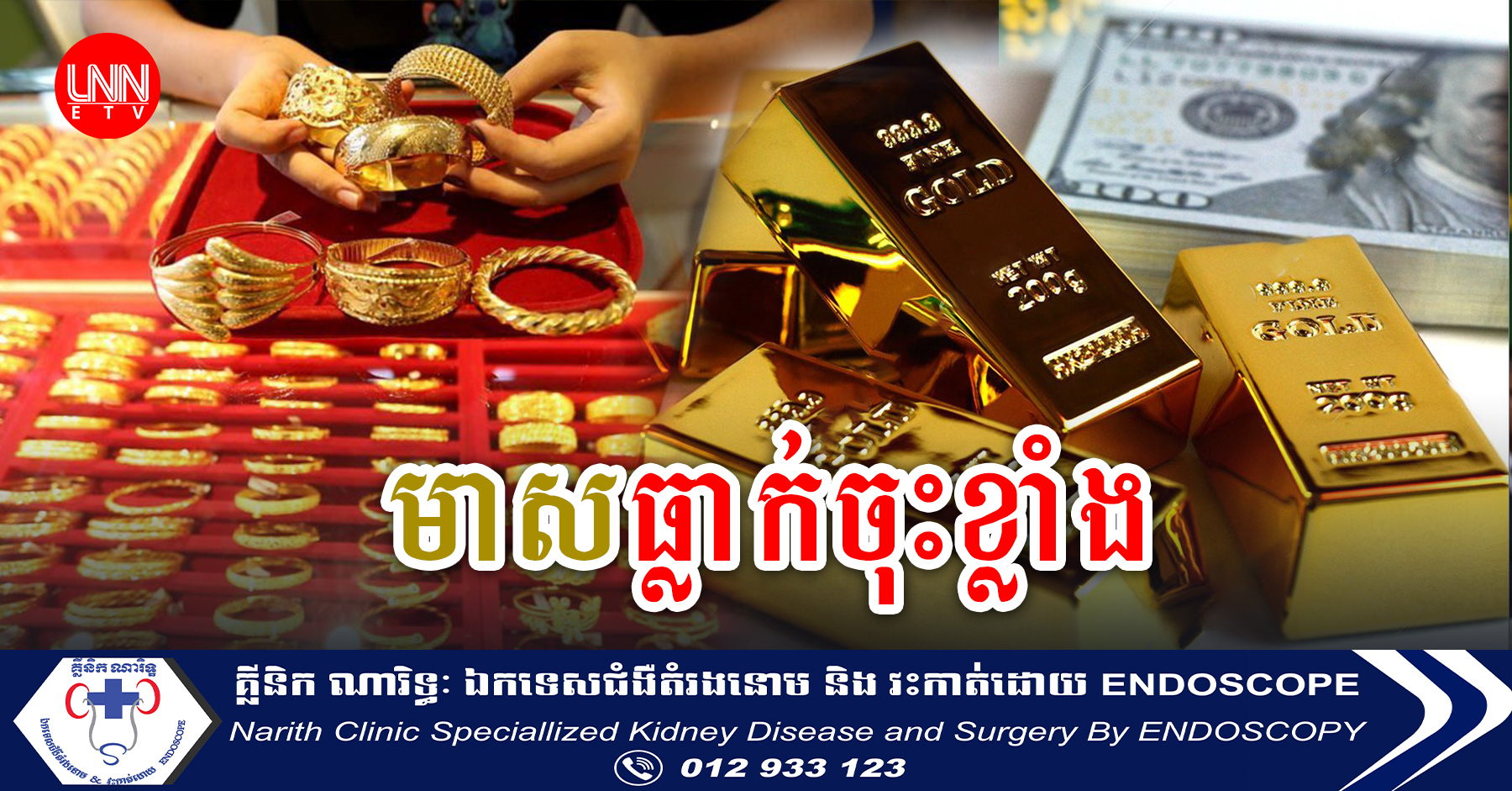 ហាងឆេងមាសលើទីផ្សារអន្តរជាតិ និងក្នុងស្រុកមានការប្រែប្រួលខ្លាំងពោលគឺធ្លាក់ចុះយ៉ាងខ្លាំង