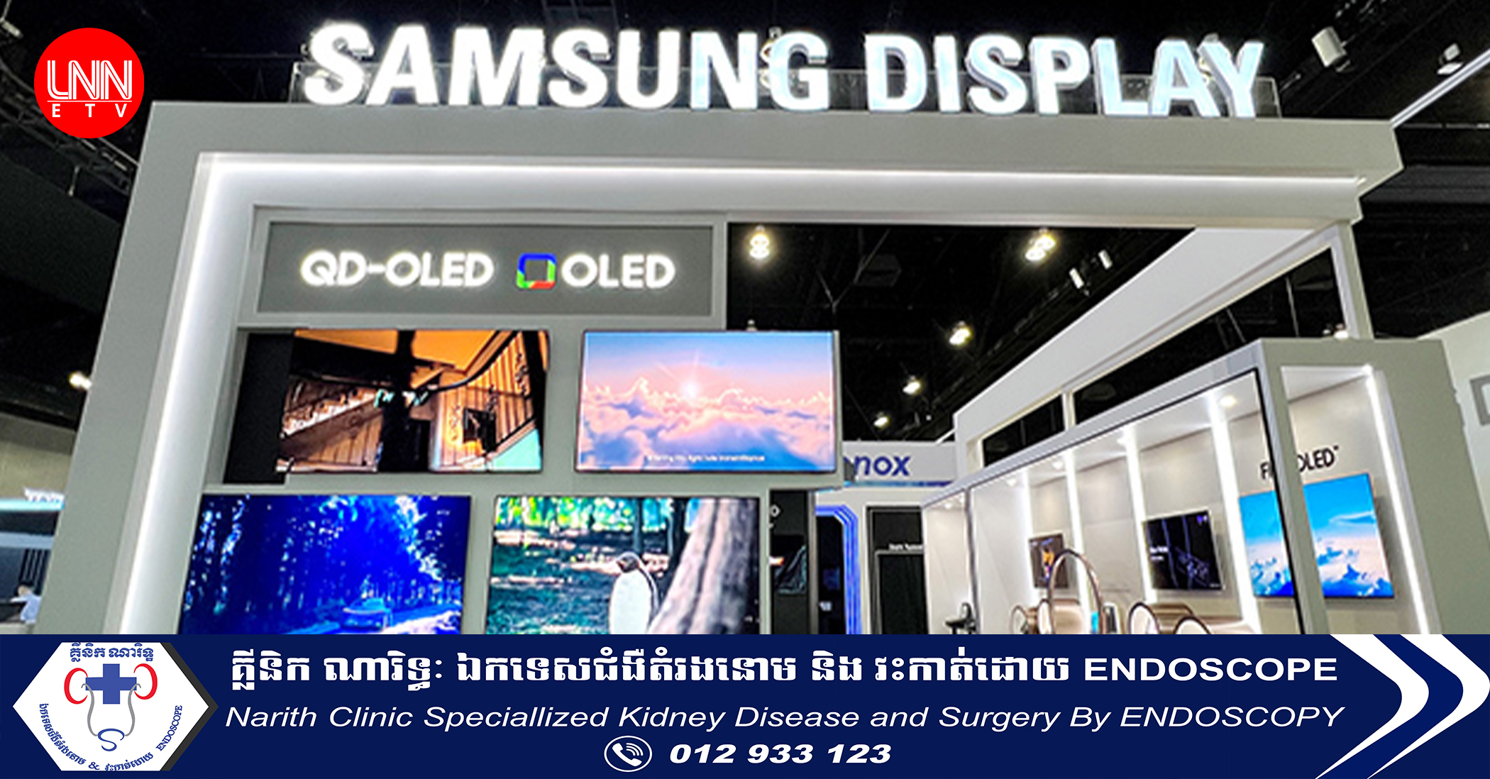 Samsung ប្តឹង​ក្រុមហ៊ុន​មួយ​របស់​ចិន ពាក់ព័ន្ធ​នឹង​ការ​រំលោ.ភ​បំពា.ន​ប៉ាតង់